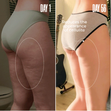 1. GET-DREAMY Is Gold For Cottage Cheese Legs